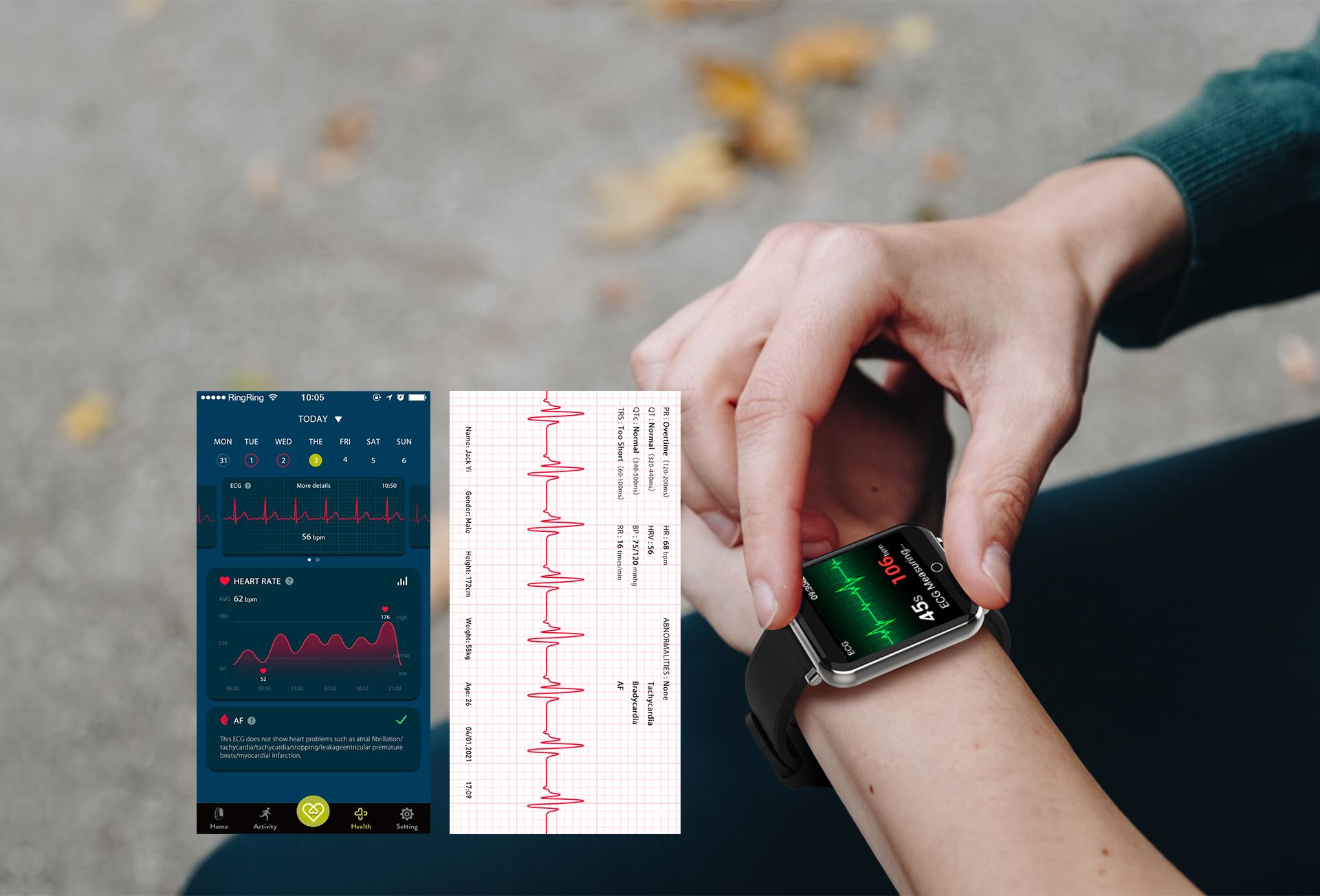 Medical Level ECG Based on Patent Algorithm<br> 