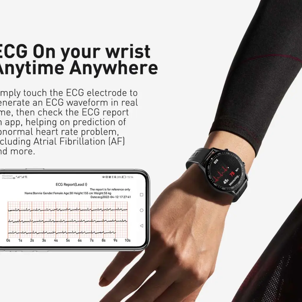 2025E Smart ECG Watch